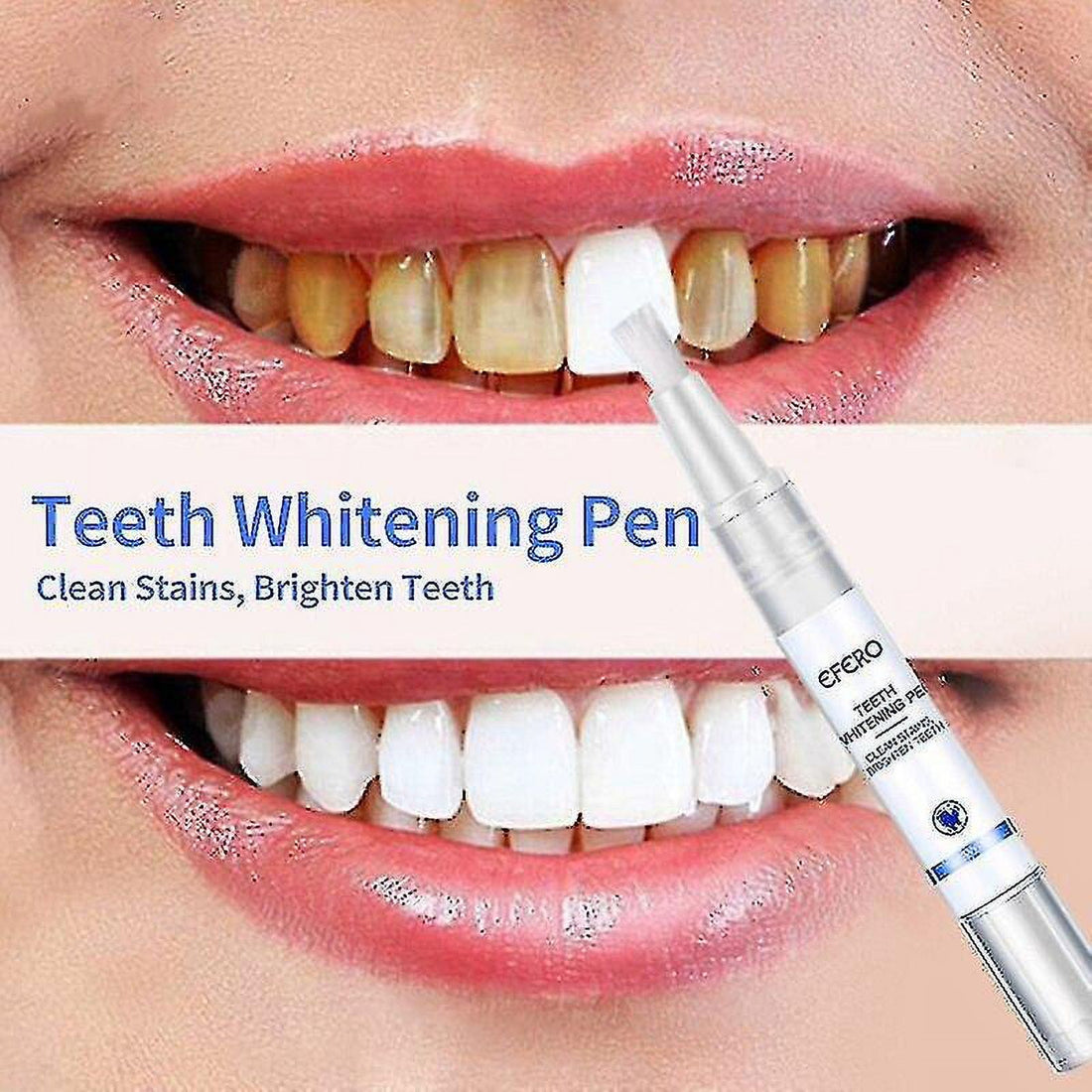 Stilou pentru albirea dintilor White Teeth, Efero, 5ml